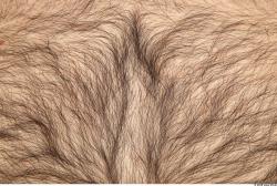 Hairy Skins